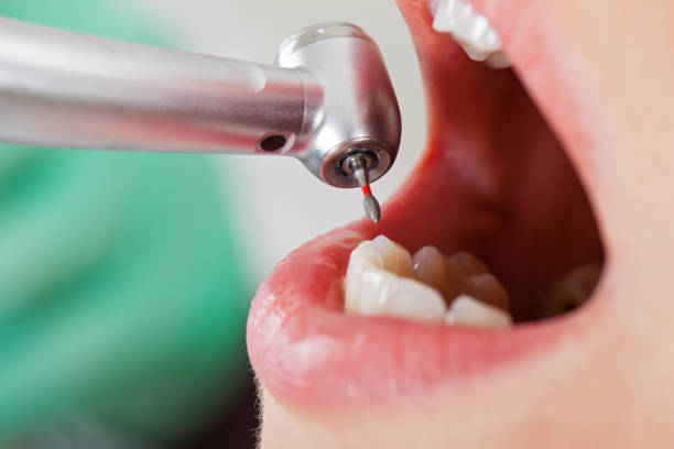 Best Emergency Broken Tooth Repair in Bentleyville, PA